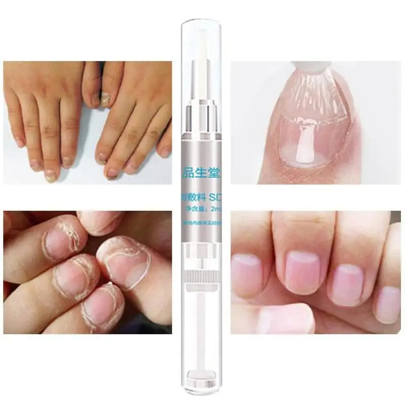 3 мл питательный раствор для удаления ногтей средство ремонта ухода за ногтями