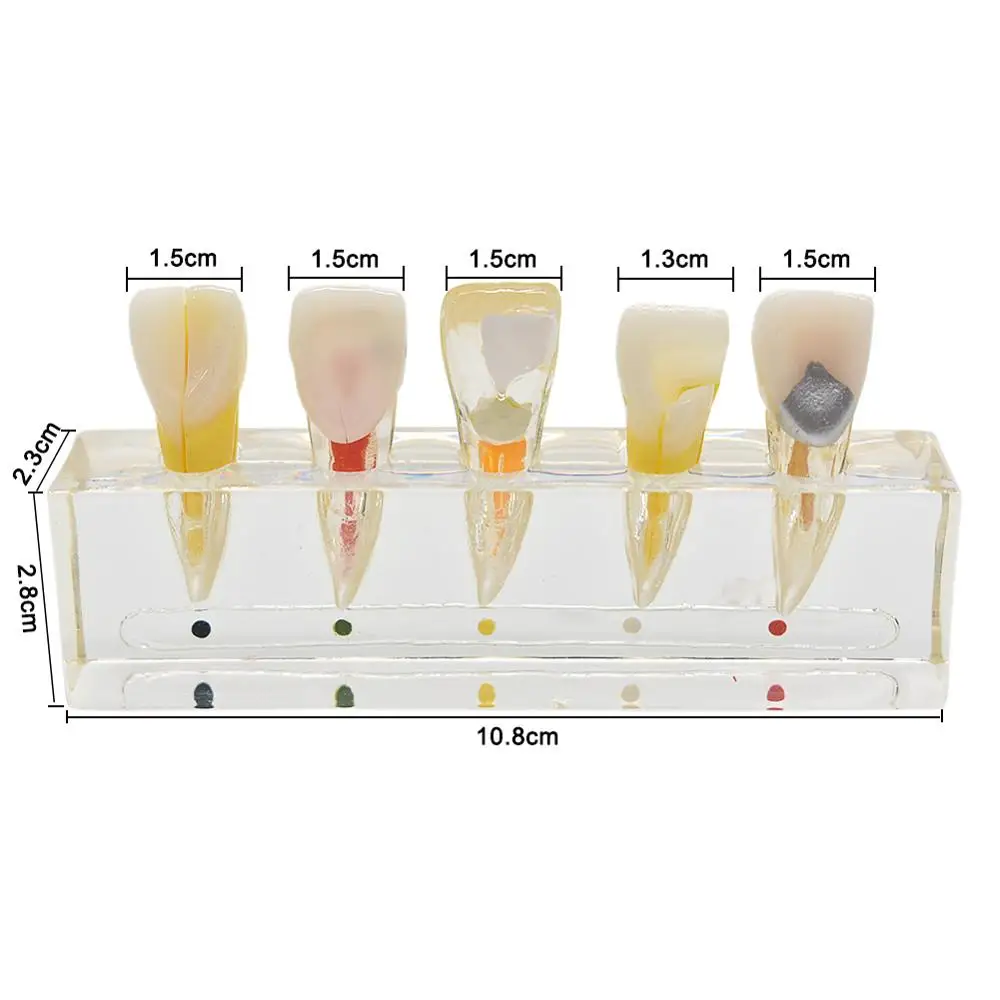 Anterior Teeth Стоматологическая пульпа восстановление патологическая модель съемные зубы рассекающие премолярные зубы полости заполнения передних задних зубов - Цвет: Anterior Teeth