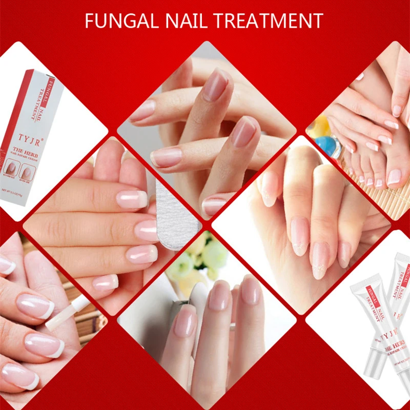 Nail Treatment Care Essence Whitening Removal Gel Fungal Cream | Красота и здоровье