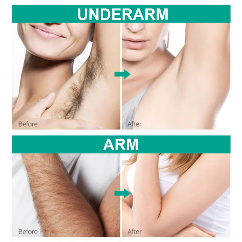 

Effective Painless Depilatory Cream Body Hair Removal Cream Whitening Hand Leg Armpit Hair Loss Product for Men and Women TSLM1