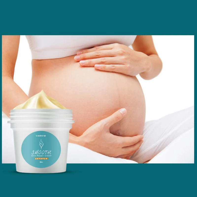 

Precious stretch marks remover scar removal Skin Body Cream powerful postpartum obesity pregnancy cream