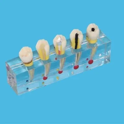 

tooth endodontium roots of recovery Step Demo Oral dental model free shipping