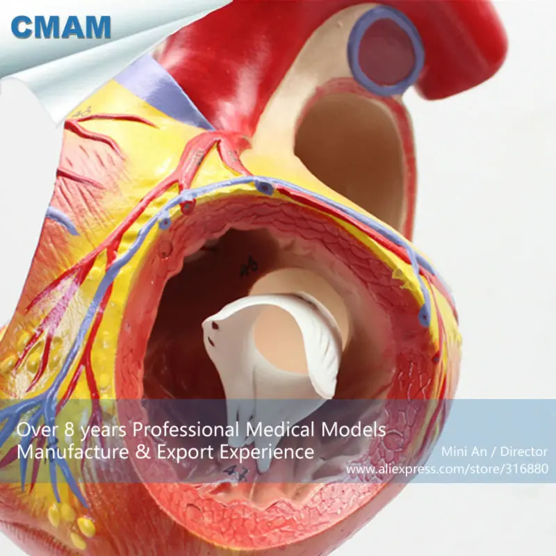 CMAM/12480 сердце-4 части, 2X Размер жизни, человеческое сердце медицинская учебная анатомическая модель