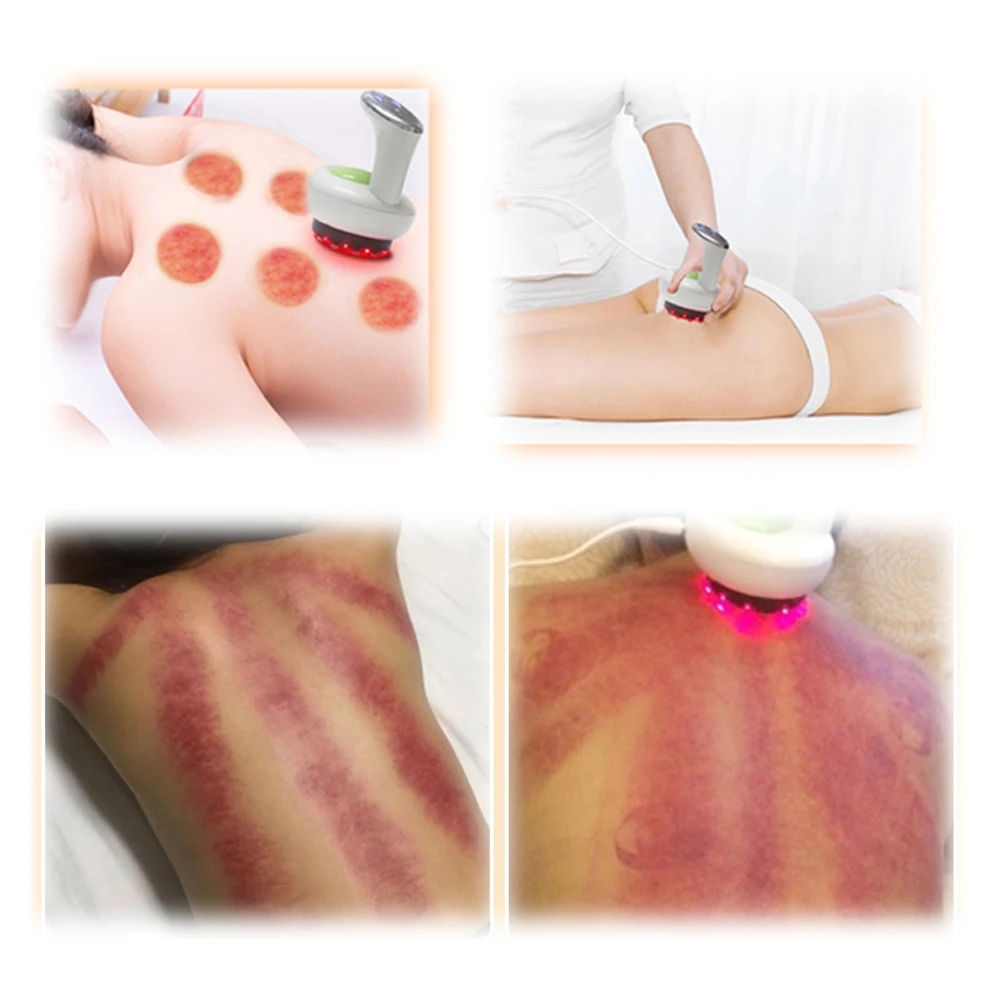 Вакуумная терапия, массажер Tens Massageador, EMS, Электрический шиацу, массажер для спины, шеи, плеч, тела, инфракрасный, с подогревом, разминание
