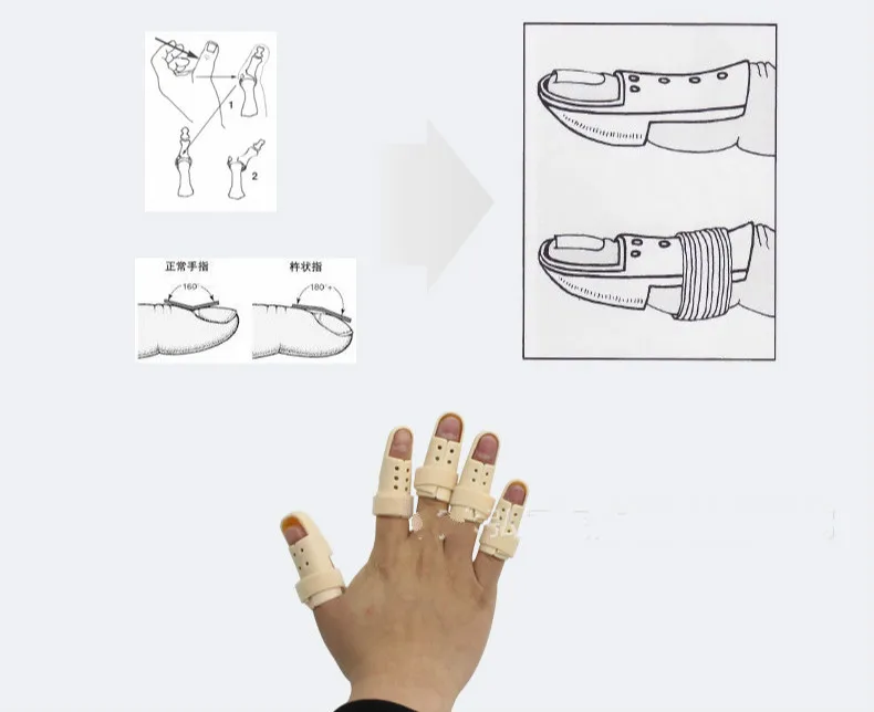 Hard Plastic Finger Splint Fracture Braces Tenosynovitis Ligament Damage Bone Care Fixing Sleeve | Красота и здоровье