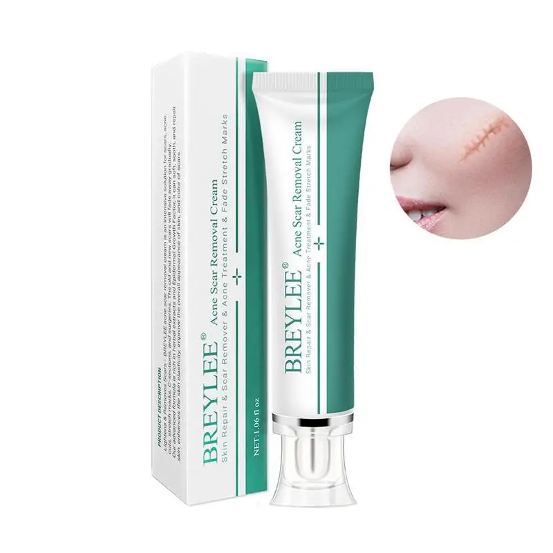 

Крем BREYLEE для удаления шрамов от акне, крем для лица, восстановление кожи, уход за кожей, лечение шрамов от акне, удаление растяжек, отбеливаю...