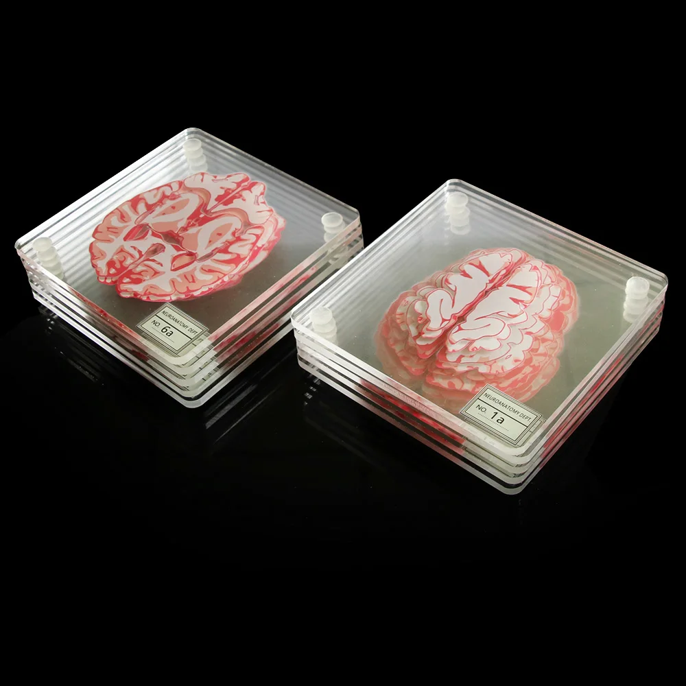 Мозговые образцы подставки набор 3D органные мозговые работы мозговые ломтики квадратная акриловая стеклянная подставка под стол для напитков подарок пьянским учёным