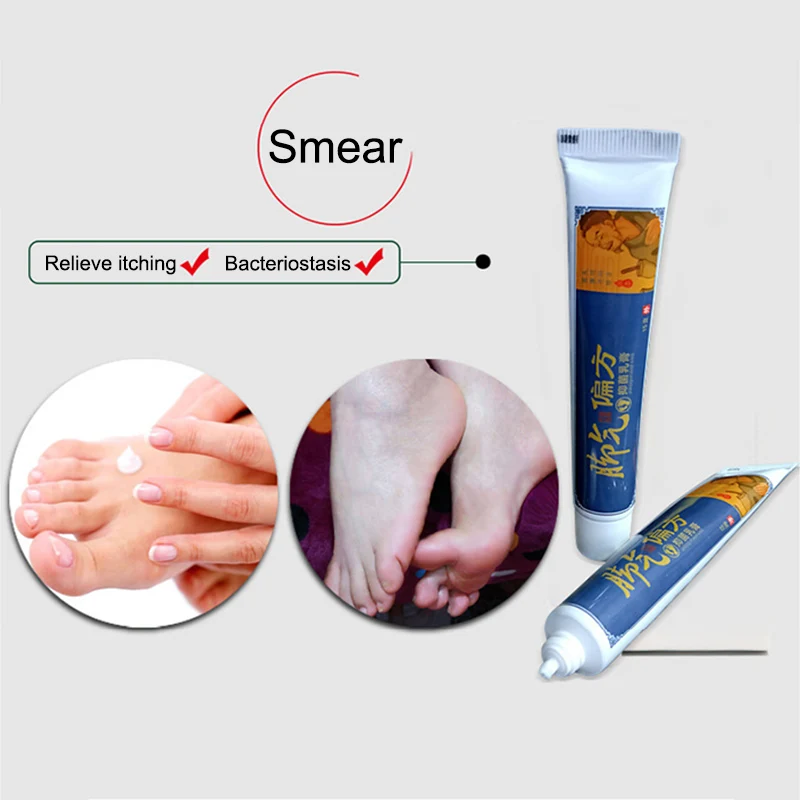 Эффективный антигрибковый крем для ног удаление грибка снятие зуда увлажняющий