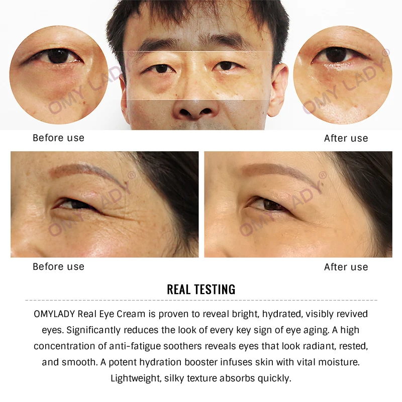 OMY LADY EyeCream мгновенное удаление очков укрепляющие глаза против отечности темные