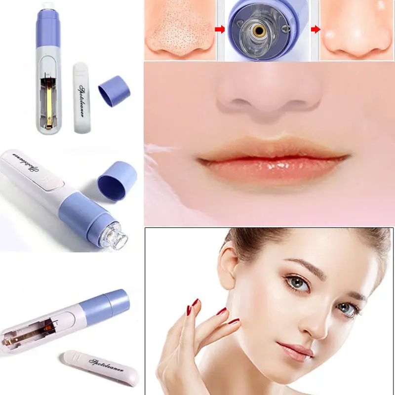 Handheld Electric Blackhead Remover Cleaner Vacuum Suction Facia Removal Skin Care Cleansing Tool | Красота и здоровье