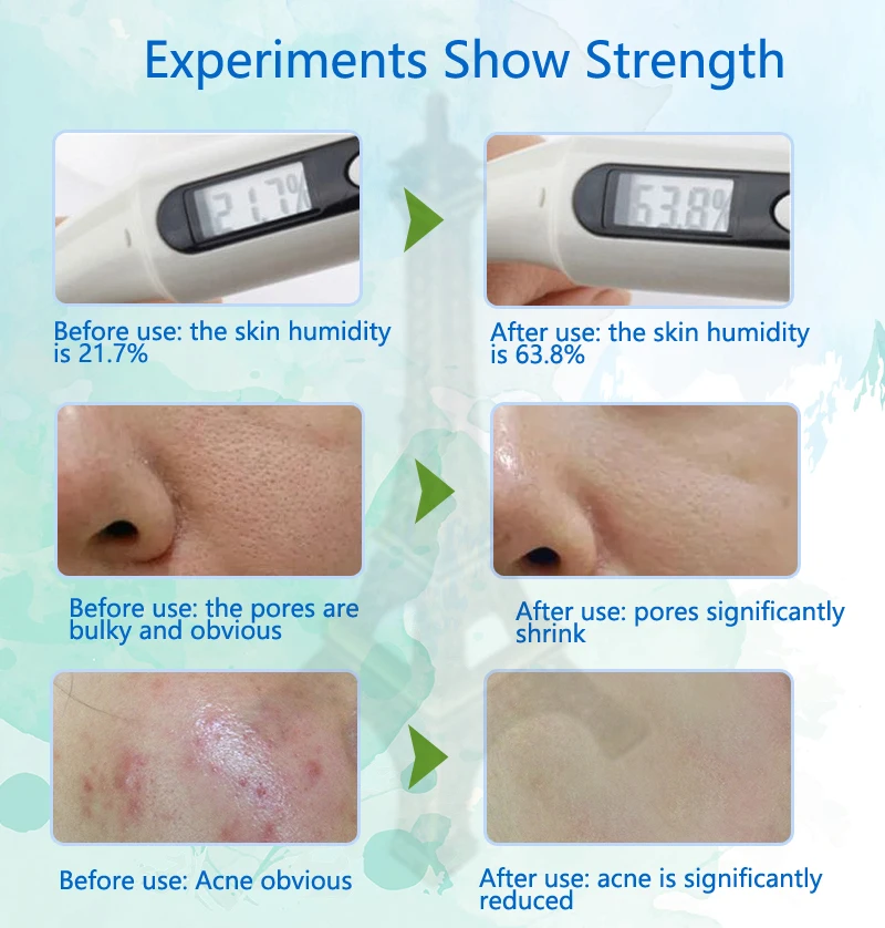 100 г 100% чистый натуральный гель с алоэ вера удаление морщин увлажнение защита от