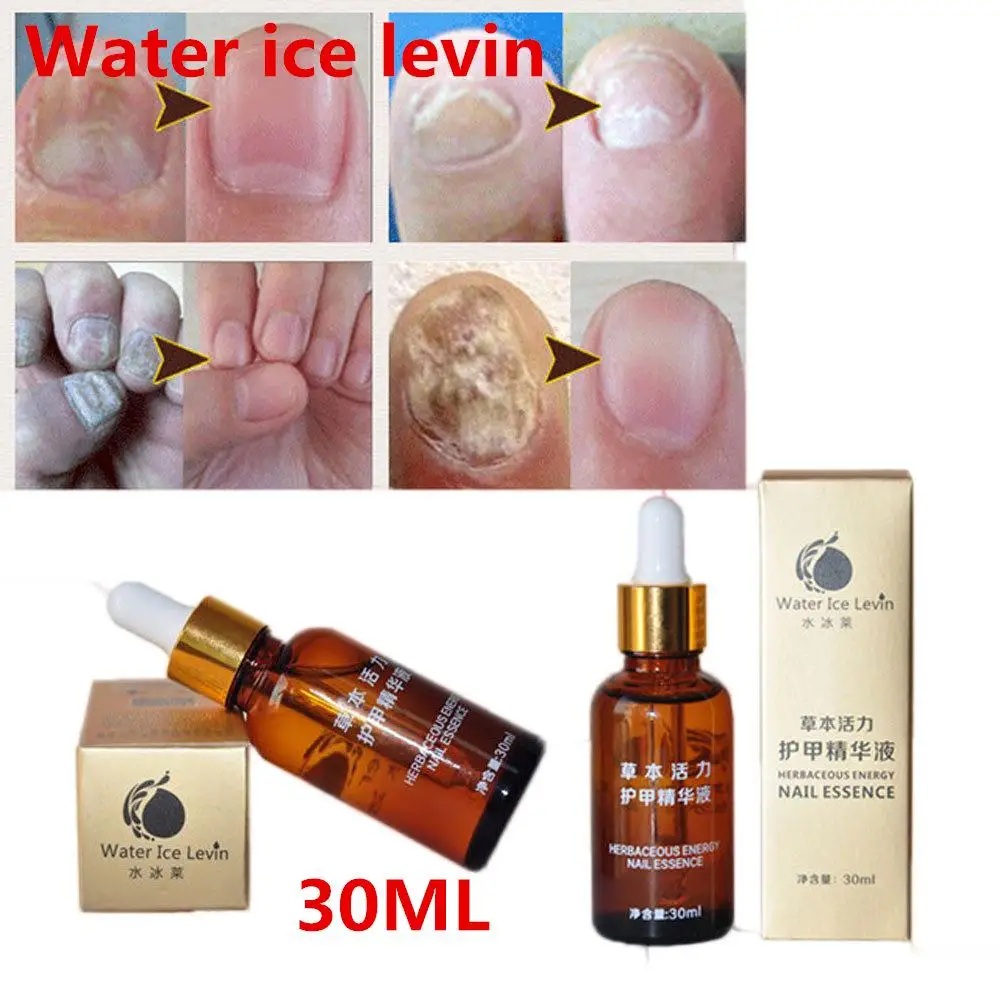 10 мл крем для лечения Ногтей онихомикоз удаление ногтей против грибковой