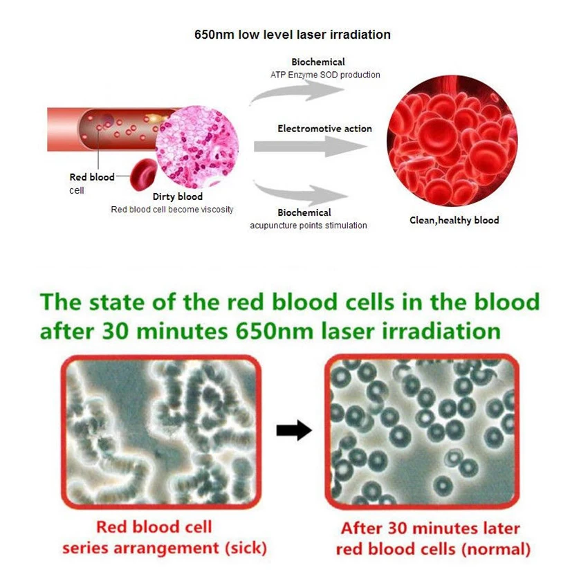 

2021 ATANG 4 Color Laser Color Therapy Device Treating Blood Pressure Stimulate The Circulation Of Blood