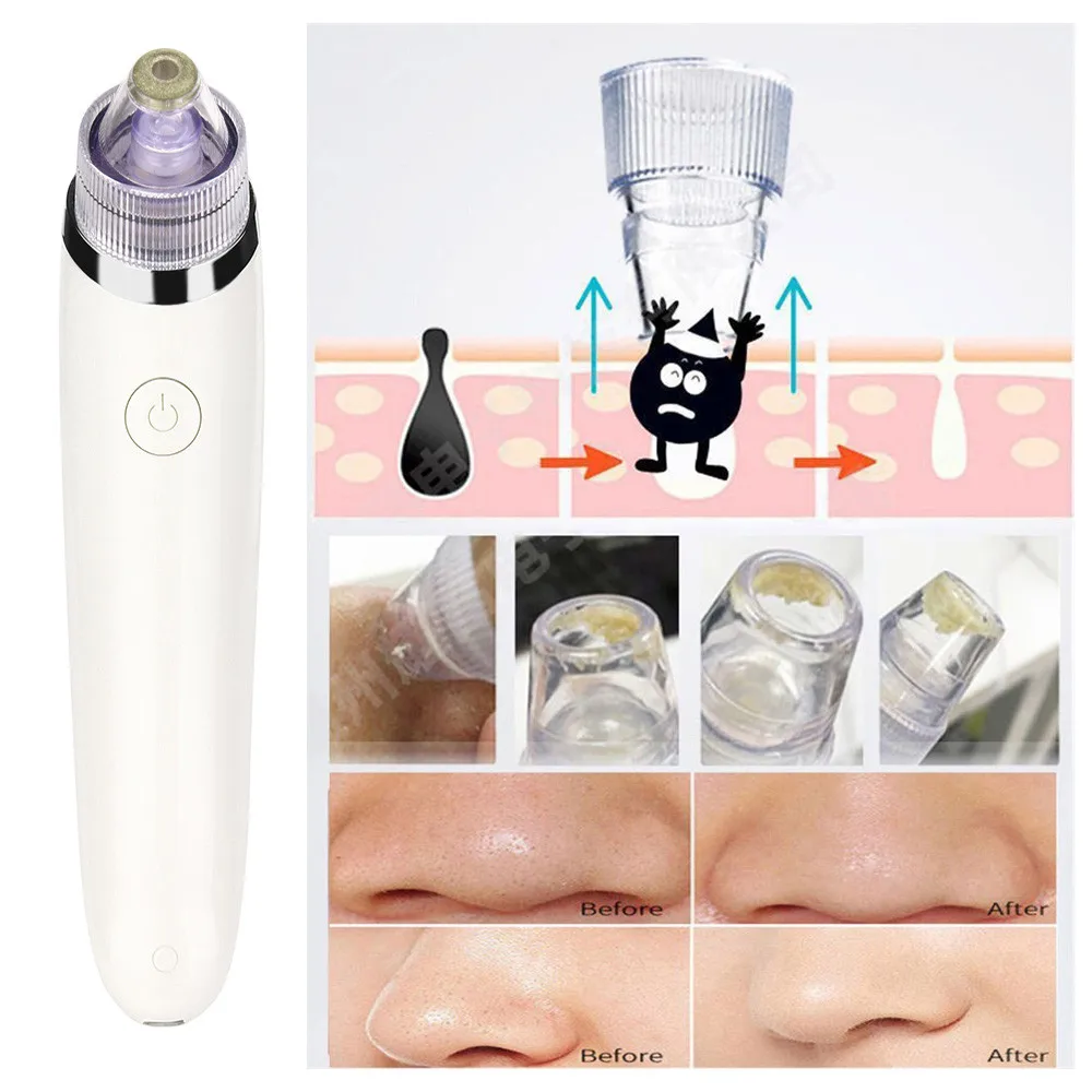 Черноголовых вакуум акне очиститель пор Remover Электрический кожи умывания