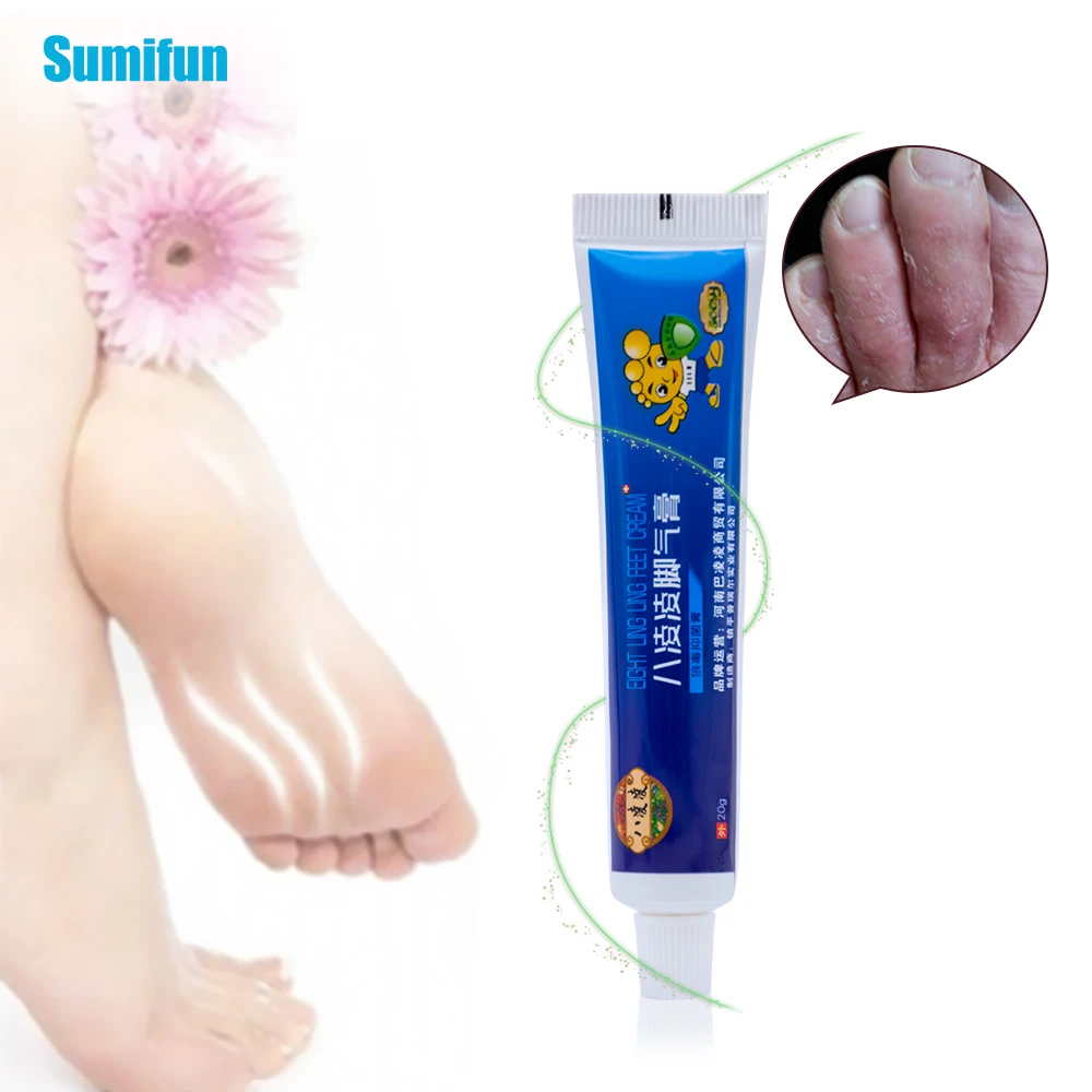 Sumifun, мягкая мазь для ухода за кожей ног, тусклый шелушитель, зуд, мозоли для ног, запах кукурузы, пот, антибактериальный крем, облегчающий боль, P1008