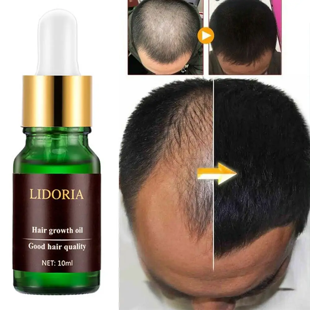 Имбирная Сыворотка для роста волос женщин и мужчин анти Предотвращение