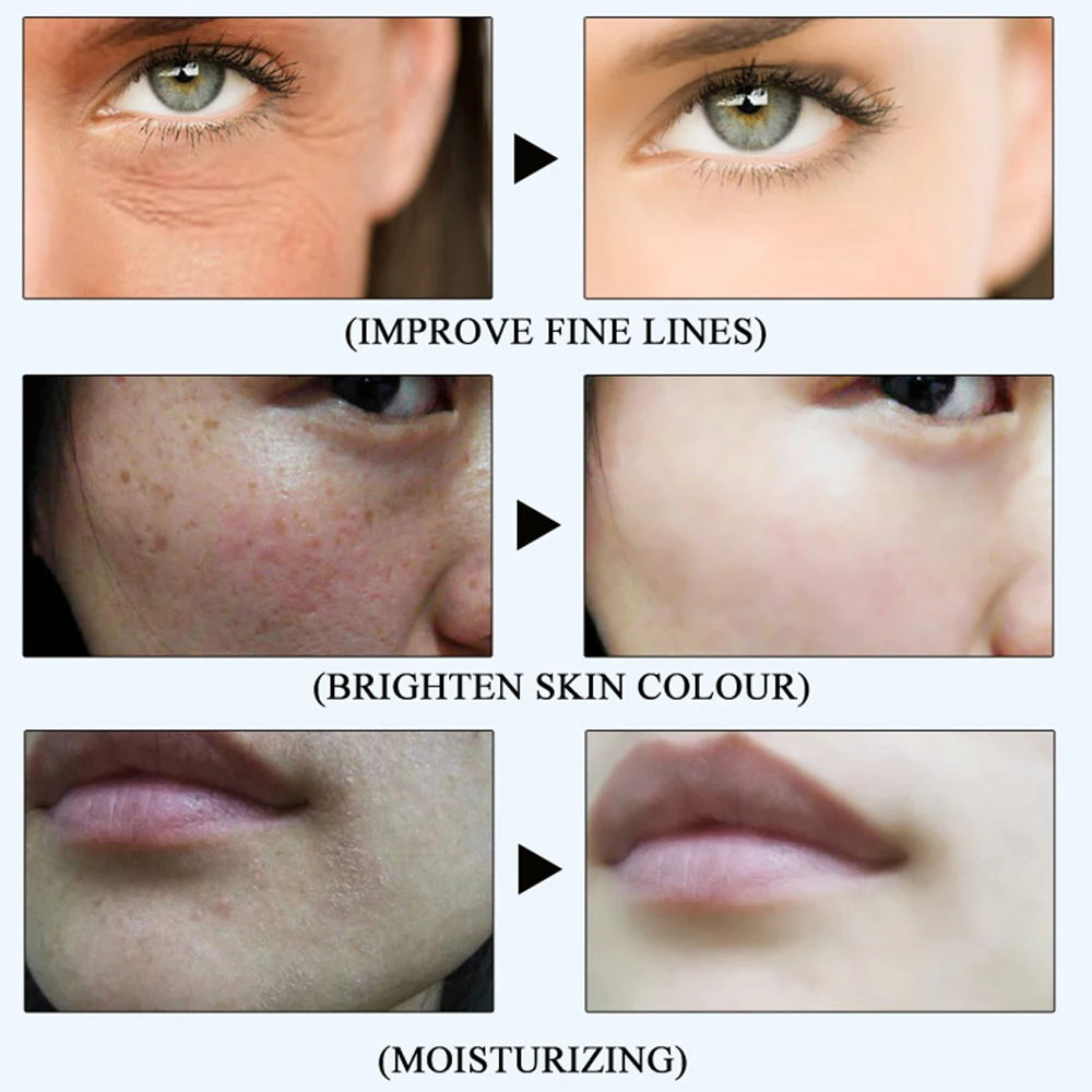 1 шт. Для женщин Отбеливание лица для ухода за кожей очищение пор на шесть