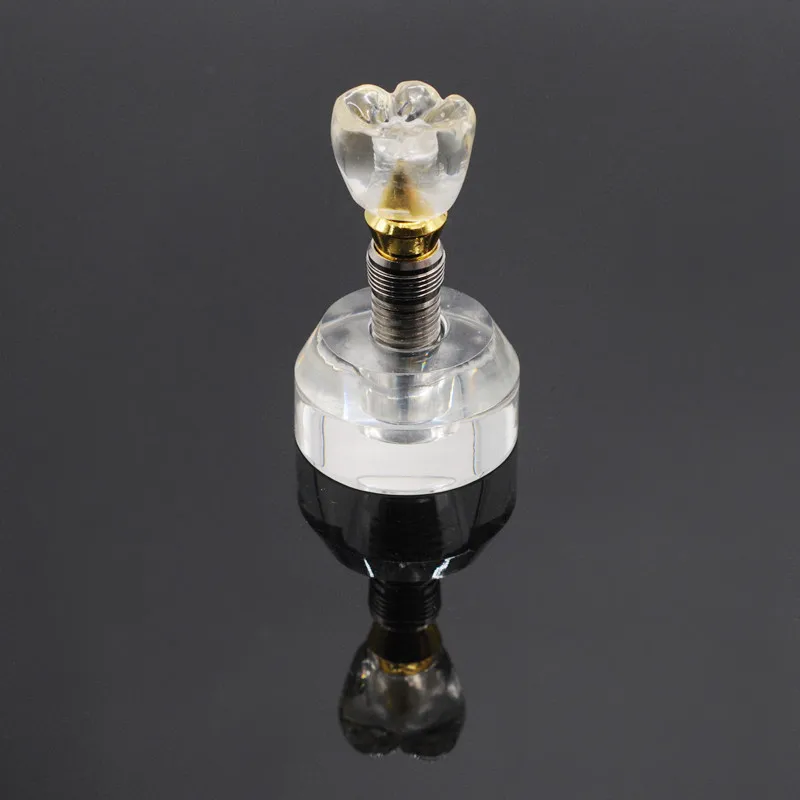 Модель зубного импланта одинарный прозрачный имплантат корона 3 детали съемный
