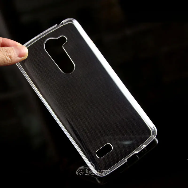 Anti-skid TPU Gel Skin Case Cover For LG Ray X190 | Мобильные телефоны и аксессуары