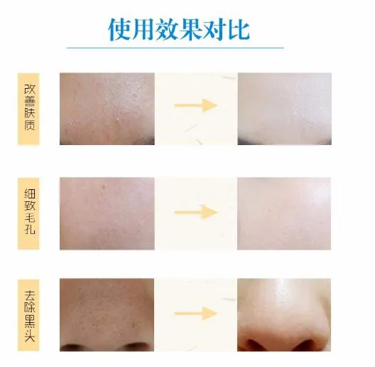 Отбеливающее очищающее молочко яркое средство 80 г лучшее для мытья лица всей