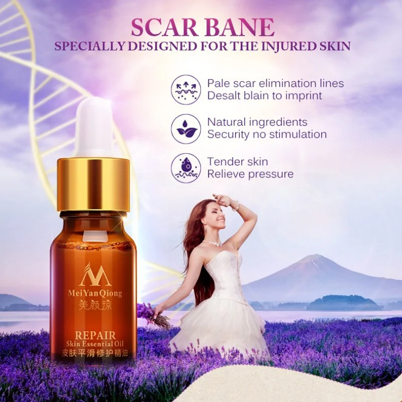 Шрам ремонт кожи эфирное масло экстракт лаванды Природный уход за кожей чистого