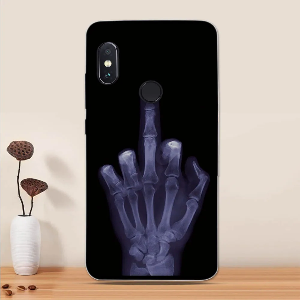 Чехол для Xiaomi Redmi Note 5 чехол для Xiaomi Redmi Note 5 Pro чехол силиконовый милый мягкий чехол для телефона для Redmi Note 5 Чехол