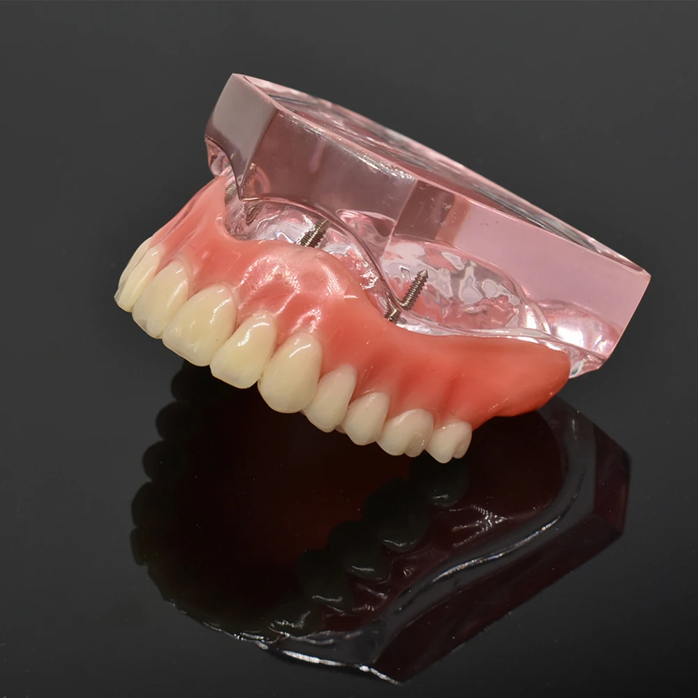 Модель зубного протеза съемная внутренняя модель нижних зубов Mandibular с