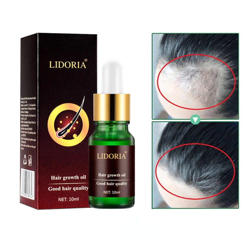 

10ml Powerful Hair Growth Essence Products Conditioner Oil Treatment Preventing Hair Loss Hair Care Repairing Regenerating Serum