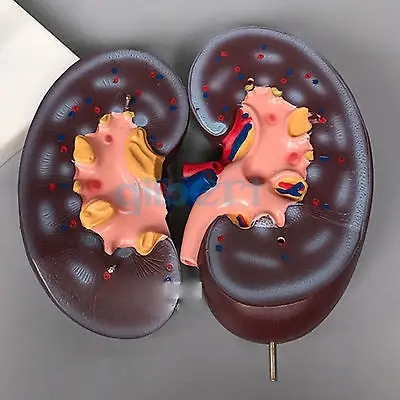 2 раза увеличенные почки человека с надпочечными железными анатомическими