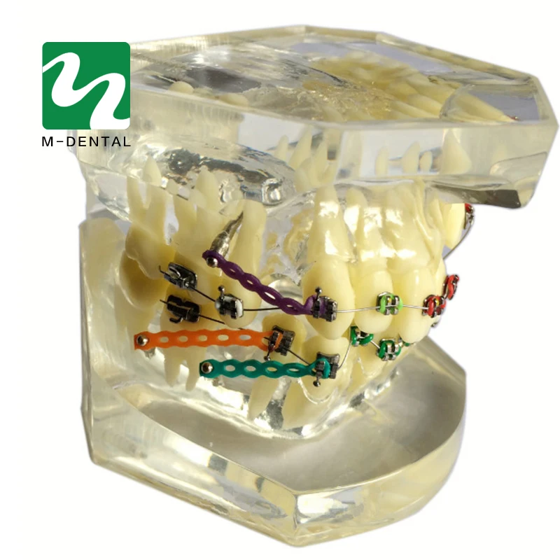 1 шт. Стоматологическая Ортодонтическая модель для обучения прозрачная с
