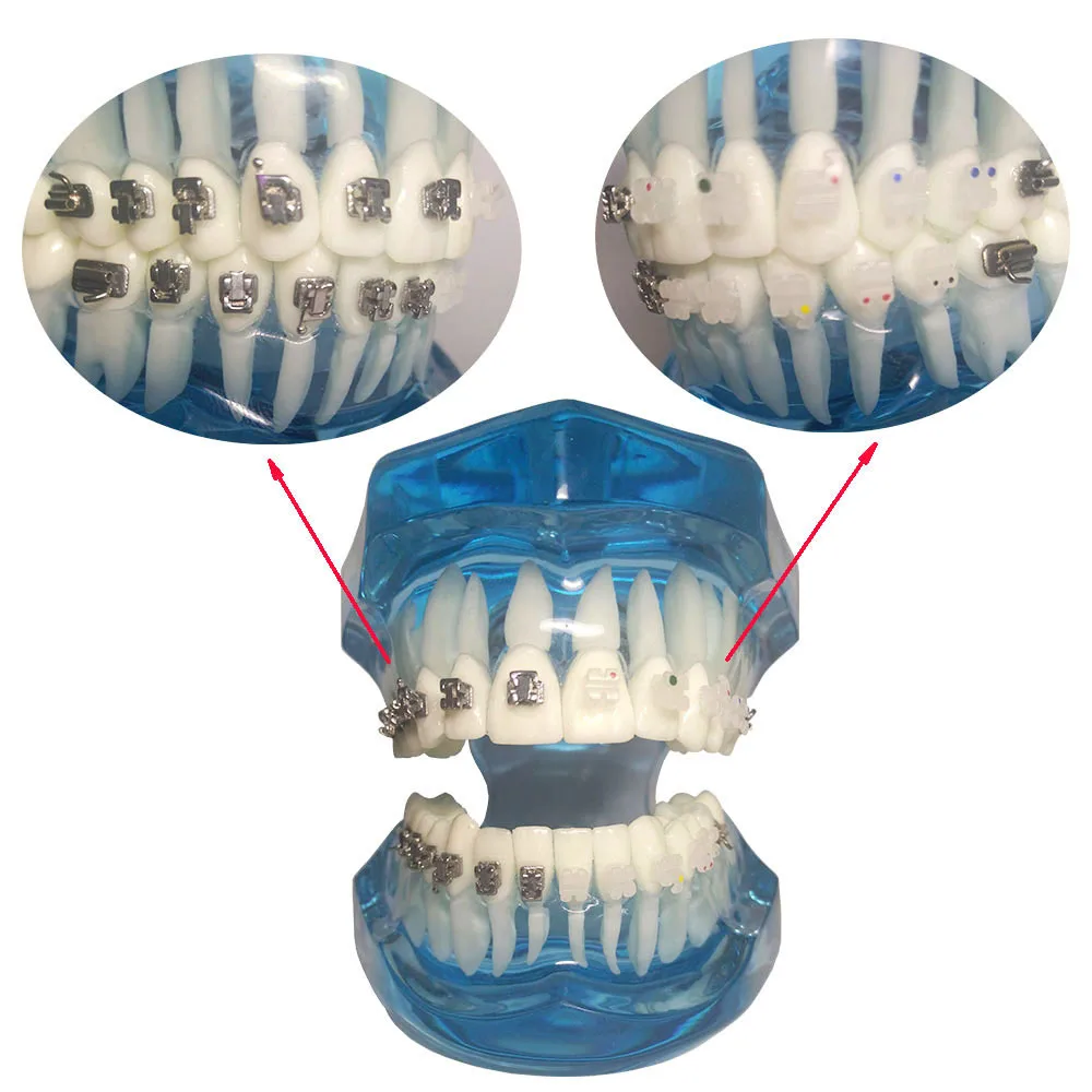 1 Piece Dental Orthodontic Teeth Model Self-ligating/Ceramic Brackets Contrast with Buccal Tubes