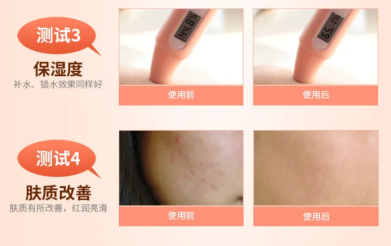 LAIKOU 5pcs Snail Skin Face Set Cleanser+Toner+Emulsion+eye Cream+face Cream Brand Cosmetics Repair Nutritious Facail Care Set