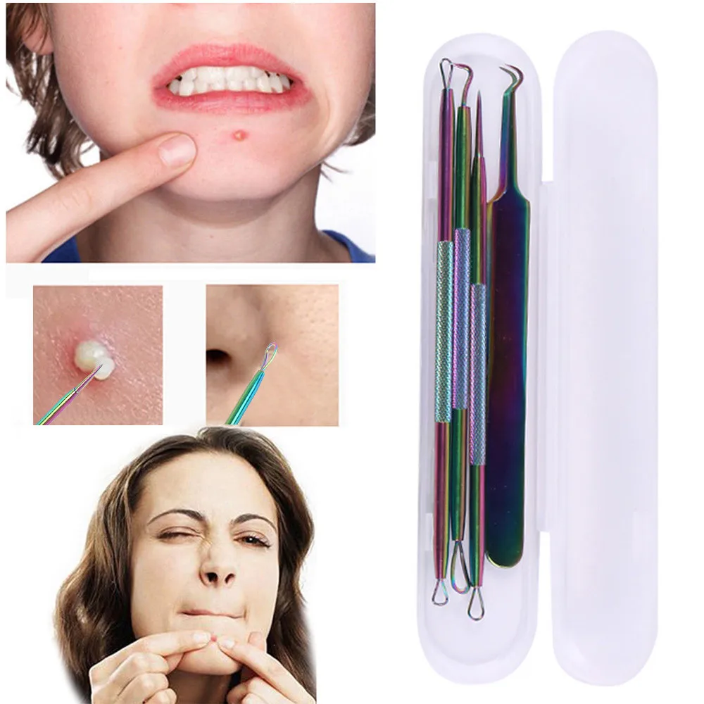 2018 Новый 4 шт./компл. красочный прыщей червячный экстрактор угрей и комедонов