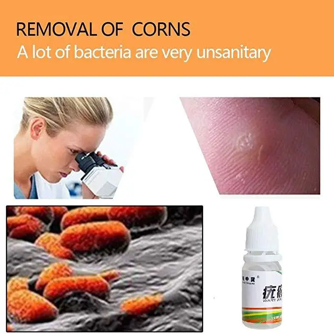 Foot Care Tools Skin Tag Remover Body Warts Treatment Foot Corn Removal Plantar Warts Ointment Foot Care Medical Plaster