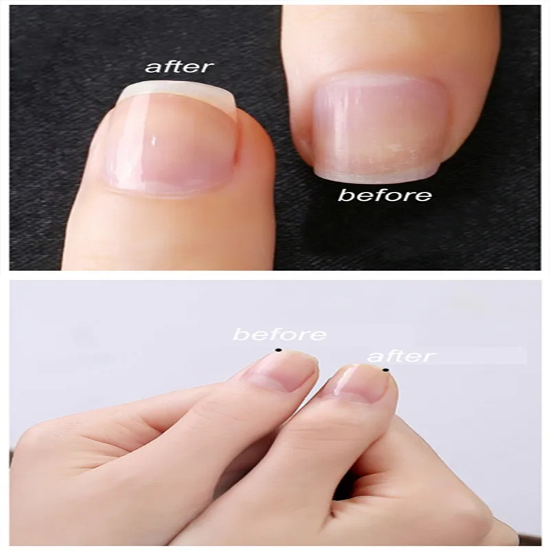 Гель zation лак-основа пальто верхнее покрытие прозрачный гель лак Отмачивание