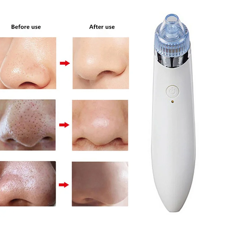 Электрический инструмент для удаления акне точка Noir Blackhead вакуумный экстрактор