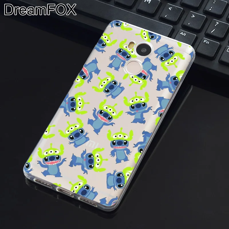 DREAMFOX M355 Stitch Soft TPU Silicone Case Cover For Xiaomi Redmi Note 3 4 5 Plus 3S 4A 4X 5A Pro Global |