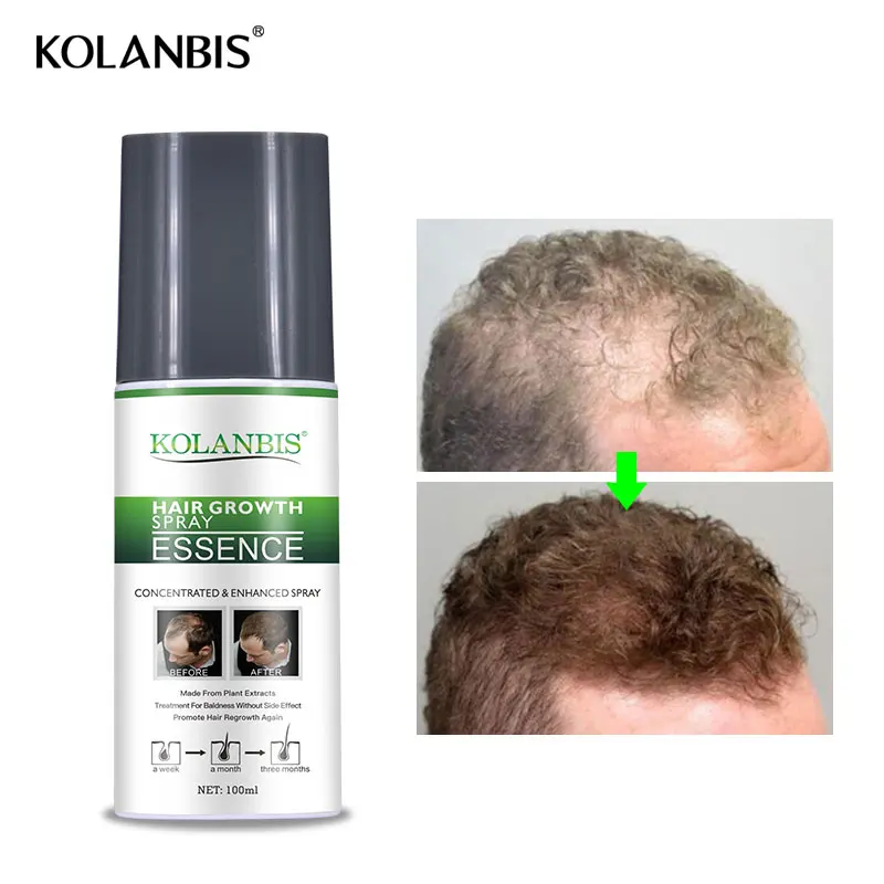Сыворотка для быстрого роста волос густая долговечная полное масло Alopecia