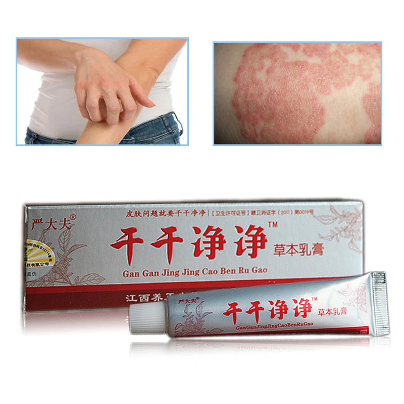 3 шт. китайская медицина псориаз для тела дерматит и экзема зуд проблемы с кожей