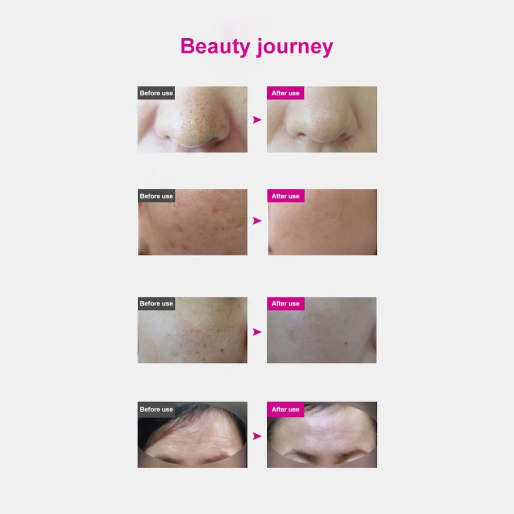 7 цветов Светодиодная маска для лица Омоложение кожи Уход за лицом лечение