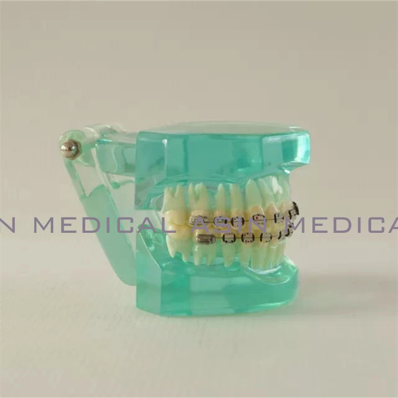 

Orthodontists model With metal & ceramic brackets Irregular tooth Ortho Metal dentist patient student learning model