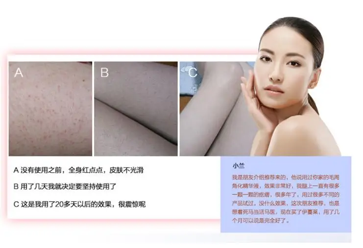 Уход за кожей тела эксфолиатор тела|bump hair|care sockscare health |