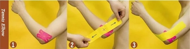 Кинезио тейпами(Kinesio tape) улучшает кровообращения и лимфотока 2074