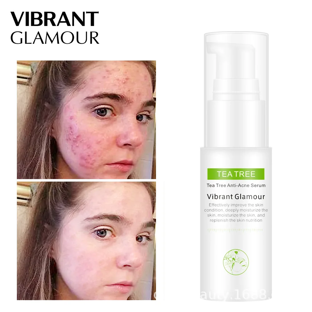 VIBRANT GLAMOUR Tea Tree Anti-Acne Serum Acne Scar Treatment To Print Anti-wrinkle Essence Oil-control Shrink Pores | Красота и