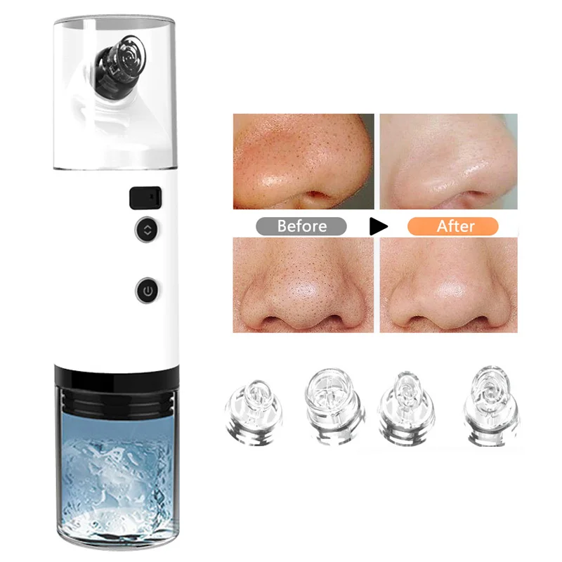 Уход за кожей Blackhead дропшиппинг по сниженной цене лица глубокие поры акне