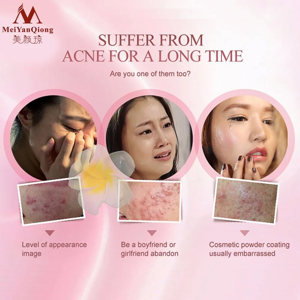 Травяной очищающий гель Уход за кожей лица анти акне лечение Крем Набор травяной