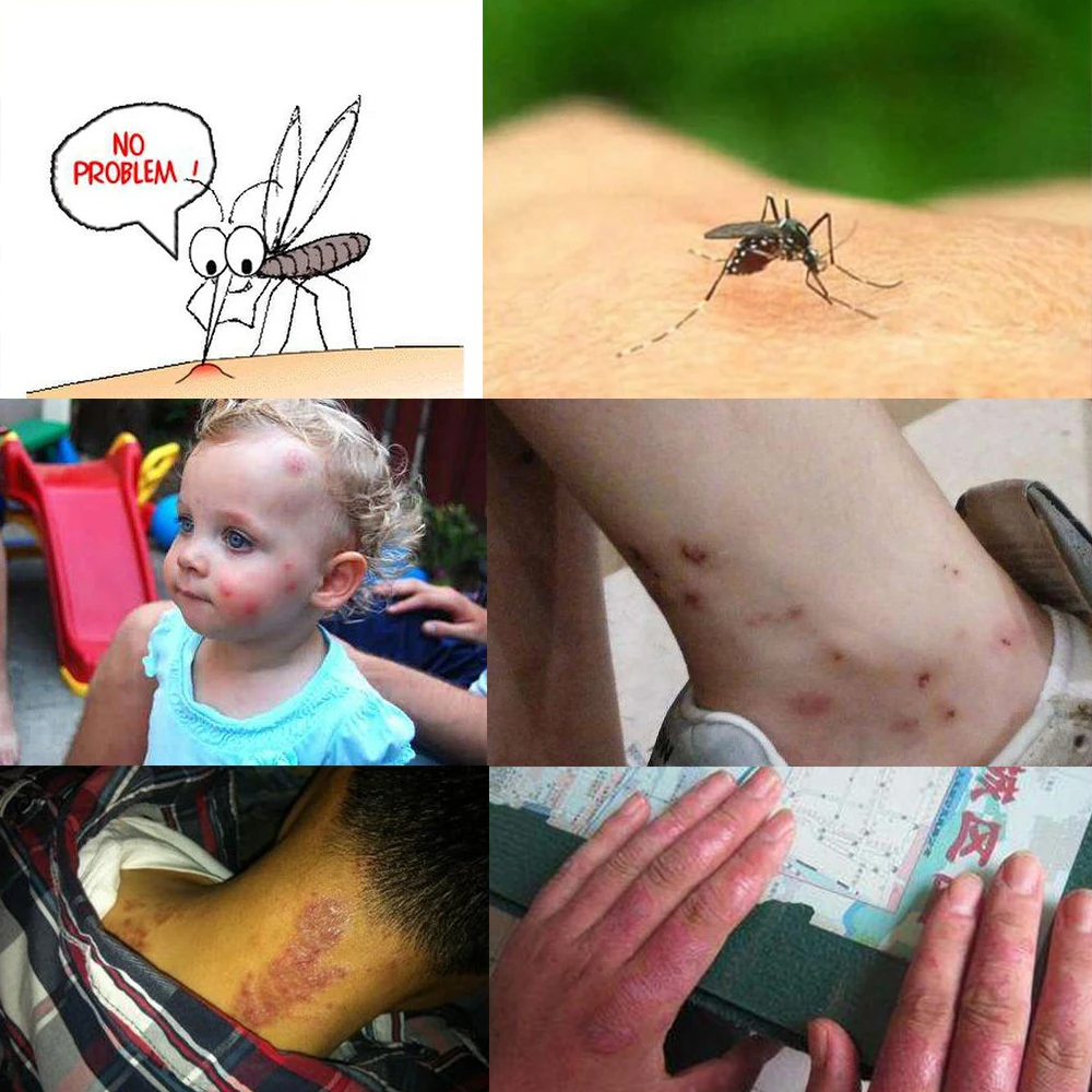 Китайская травяная паста тибетская кожа актуальная антипригарная мазь крем