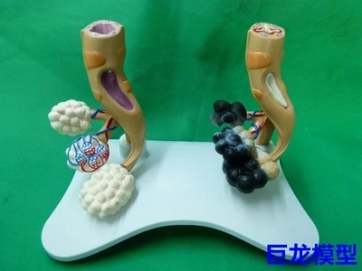 human Lung anatomy pathology Lung model and Healthy lungs comparative free shipping