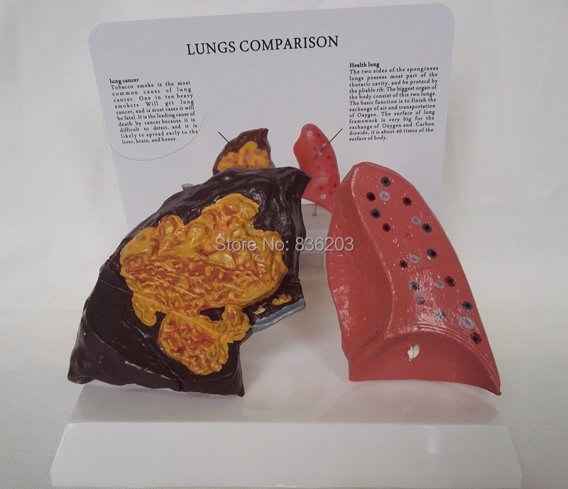 Медицинский шприц для обучения при раке легких|lungs model|human lung modelmodel lungs |