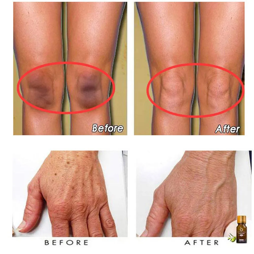 Эфирное масло 2 шт. чистое натуральное эфирное сверхосветляющее беззристое